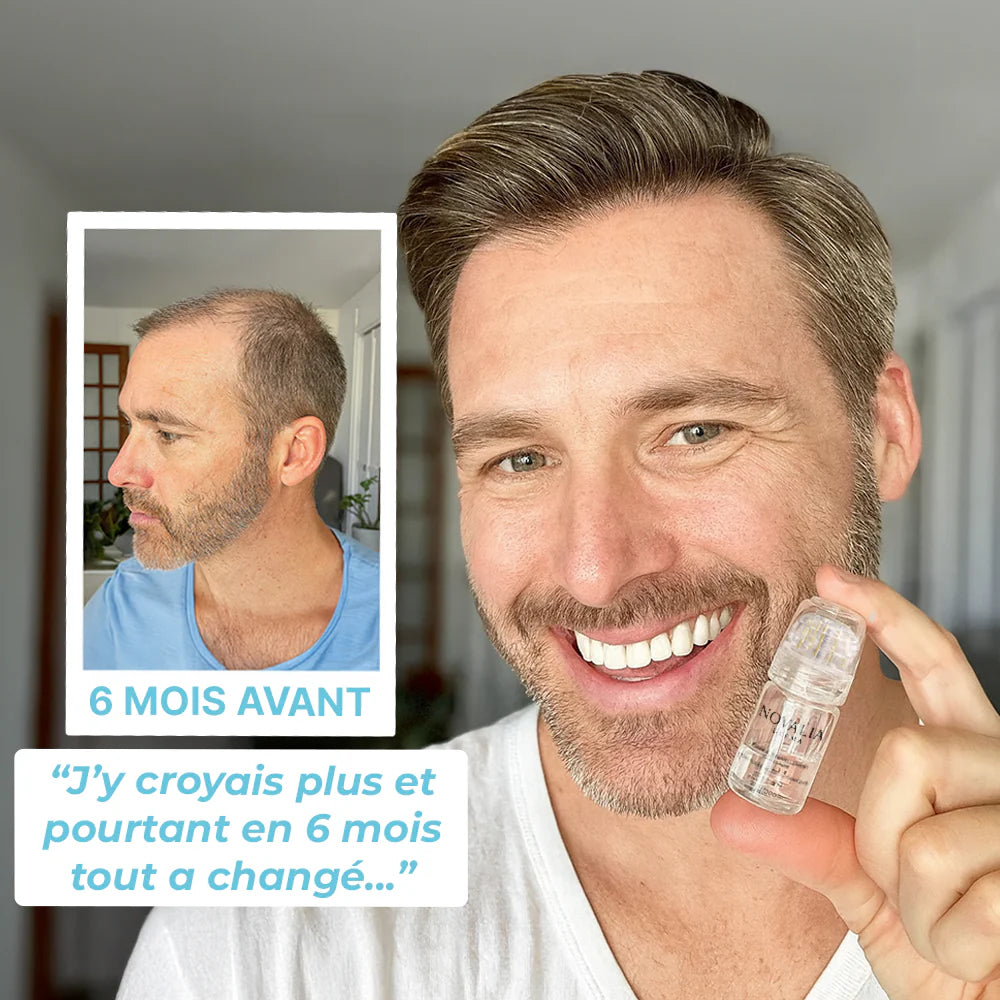 NovaliaDerma® - Renouvellement Capillaire